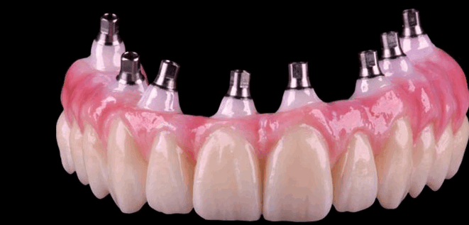 Циркониевые Зубы Фото